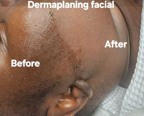 gallery image in our gallery