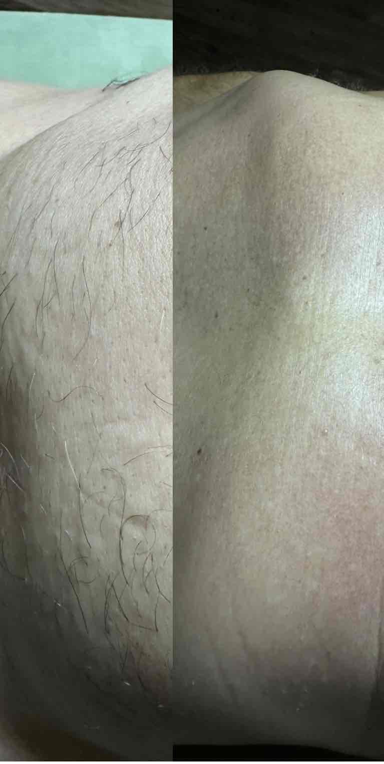  before-after,skin-treatment,comparison 