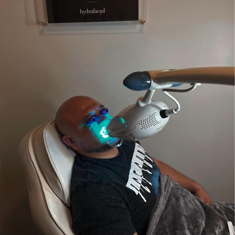 Teeth Whitening