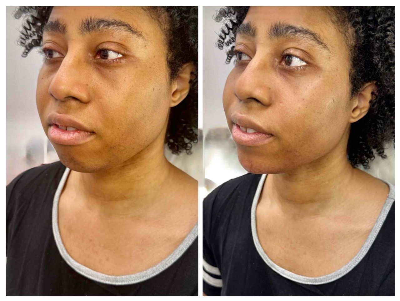 before and after,transformation,skincare,comparison