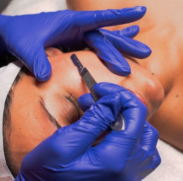Dermaplaning