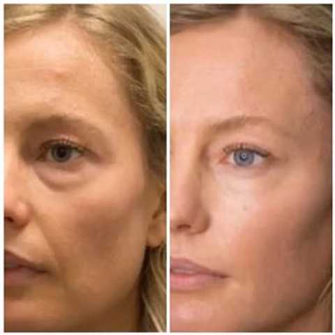 gallery image in our gallery