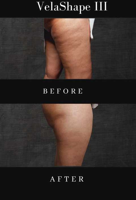 gallery image in our gallery