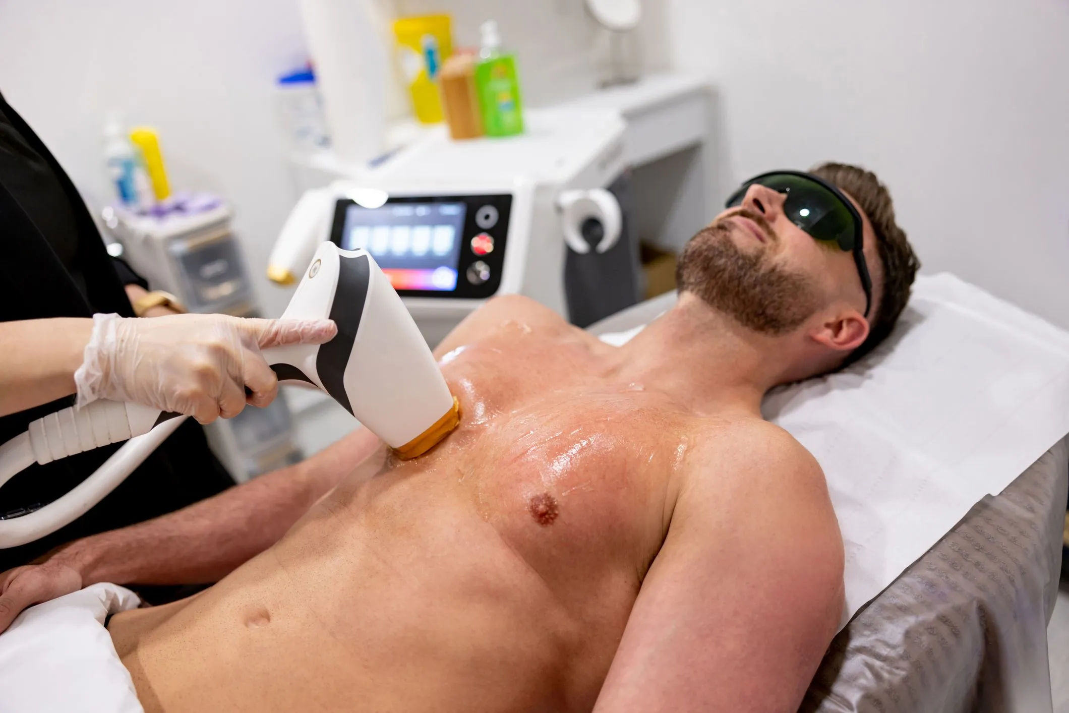 LASER HAIR REMOVAL FOR MEN