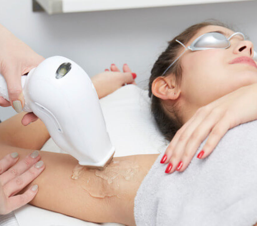 Laser Hair Removal for women