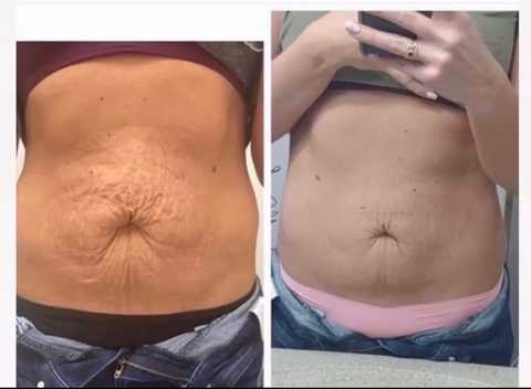 gallery image in our gallery