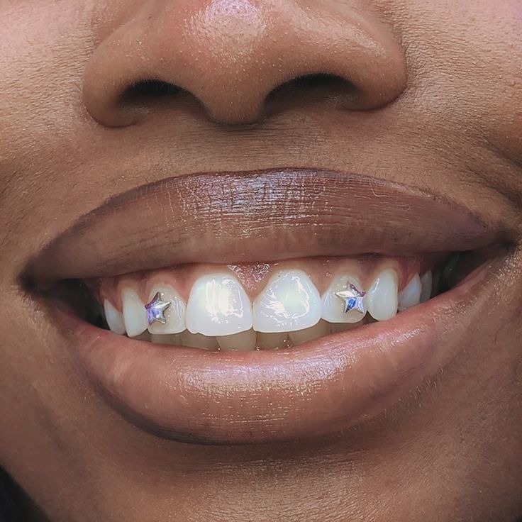 Teeth Whitening & Gems