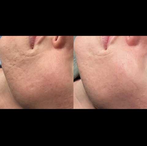 gallery image in our gallery