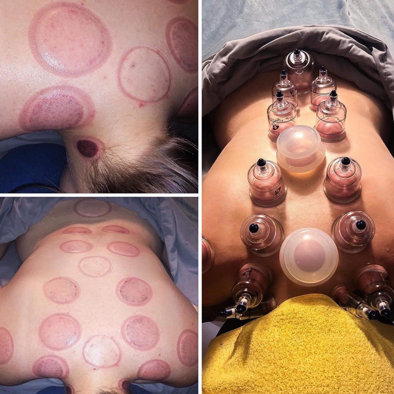 Deep Tissue Massage