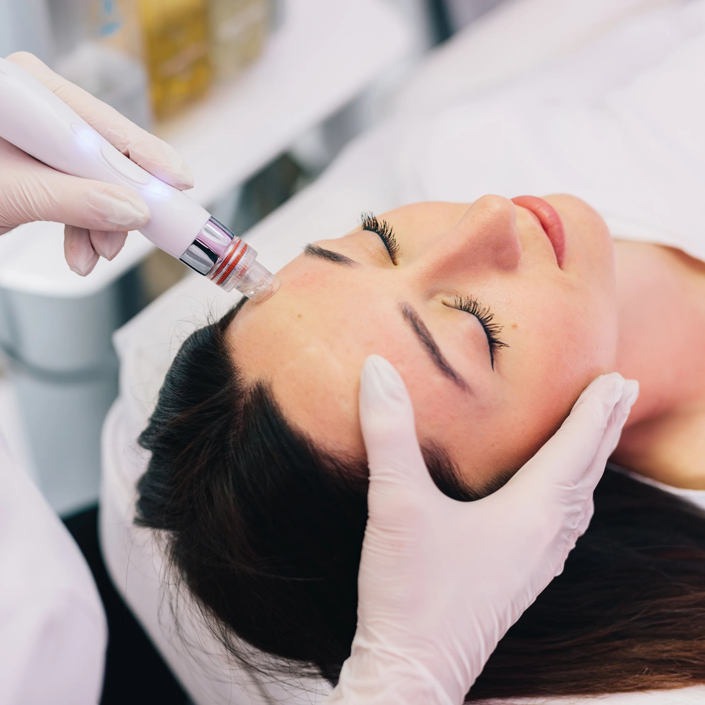 Hydrafacials
