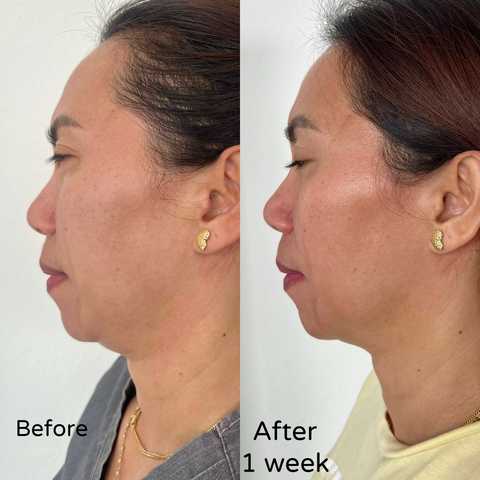 gallery image in our gallery