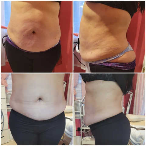 gallery image in our gallery