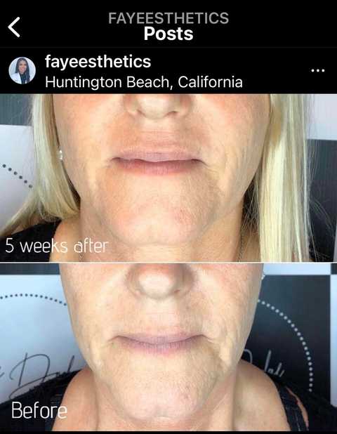 gallery image in our gallery