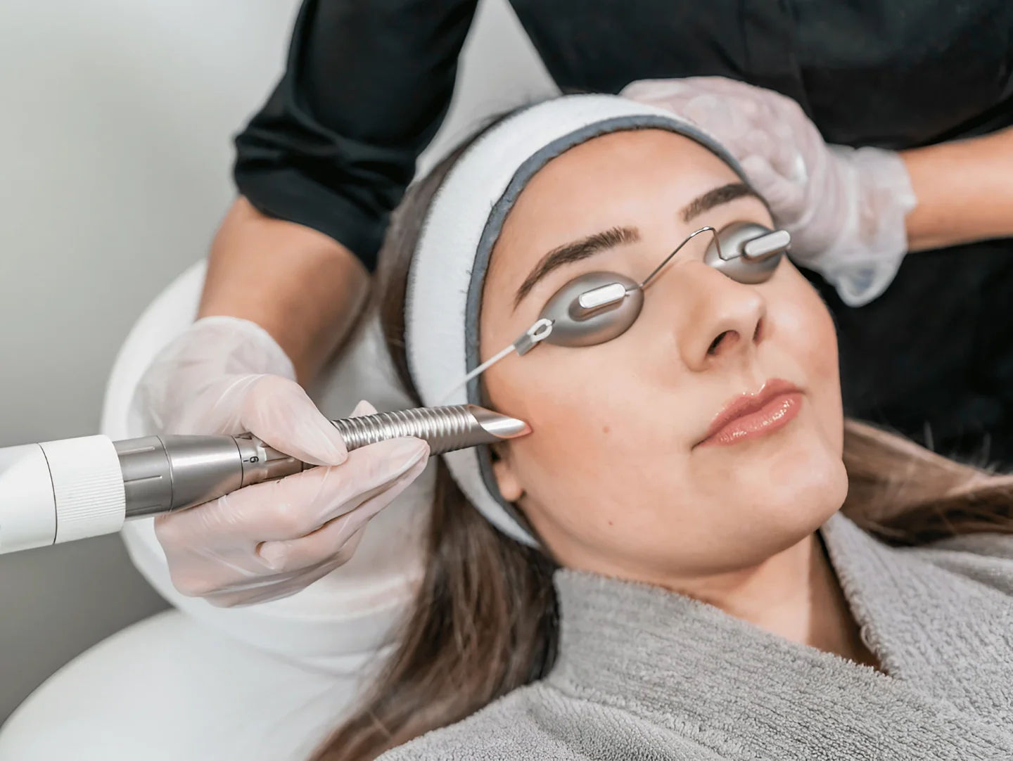 IPL Photofacial