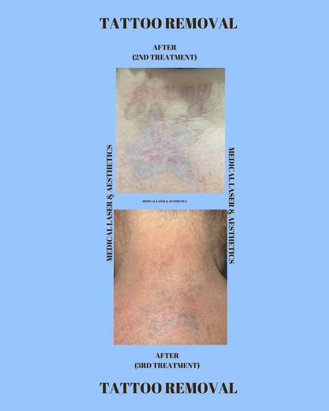 gallery image in our gallery