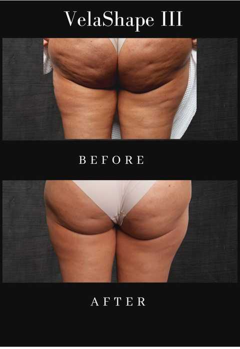 gallery image in our gallery