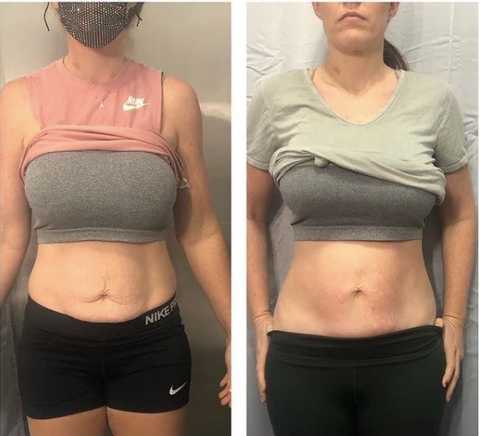 gallery image in our gallery