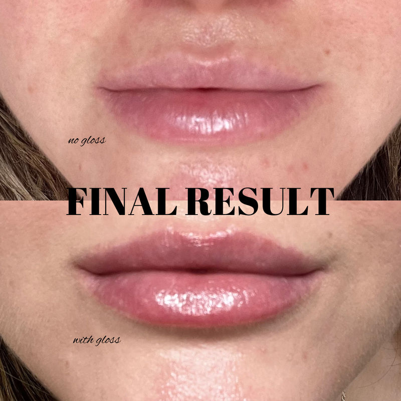 Injectables