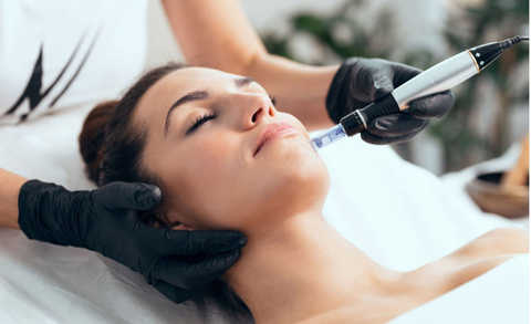 Microneedling Treatment