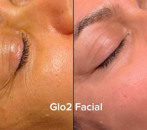 gallery image in our gallery