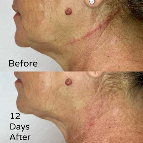 gallery image in our gallery