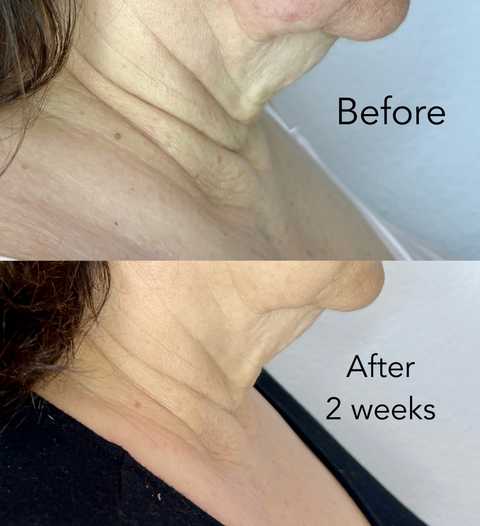 gallery image in our gallery