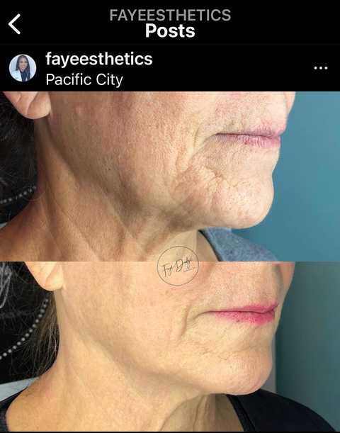 gallery image in our gallery