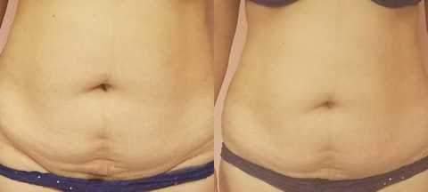 gallery image in our gallery