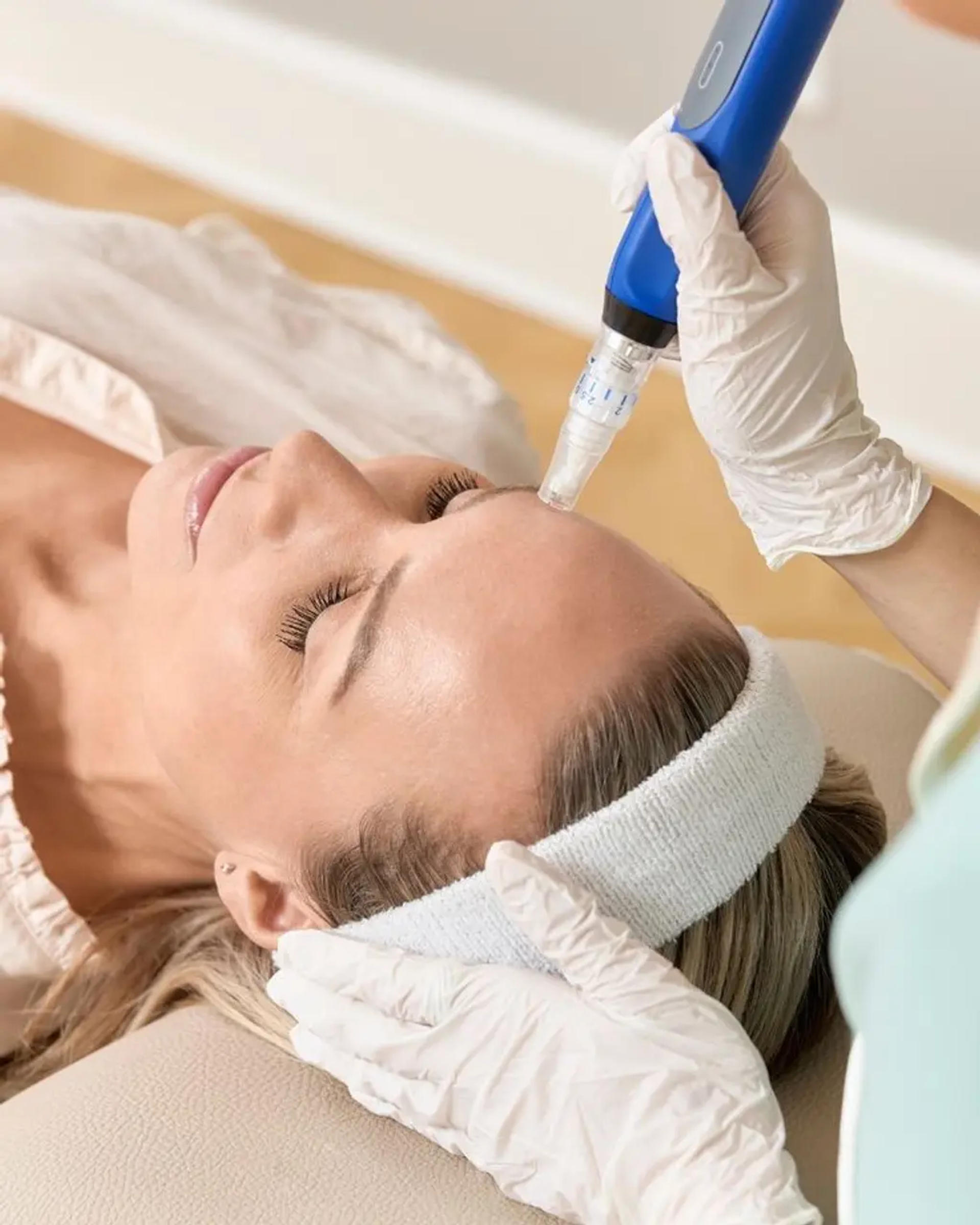 SkinPen Microneedling