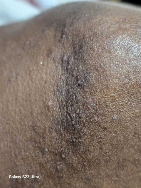 gallery image in our gallery