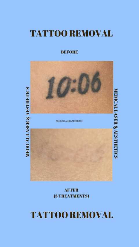 gallery image in our gallery