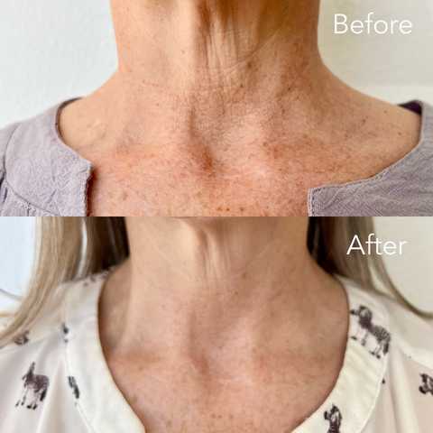 gallery image in our gallery