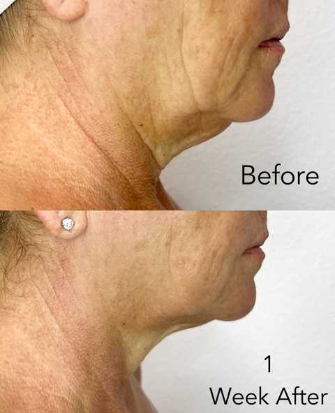 gallery image in our gallery