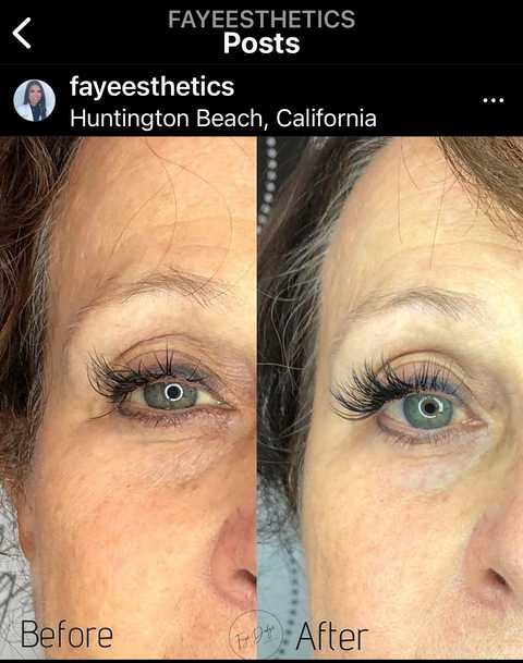 gallery image in our gallery