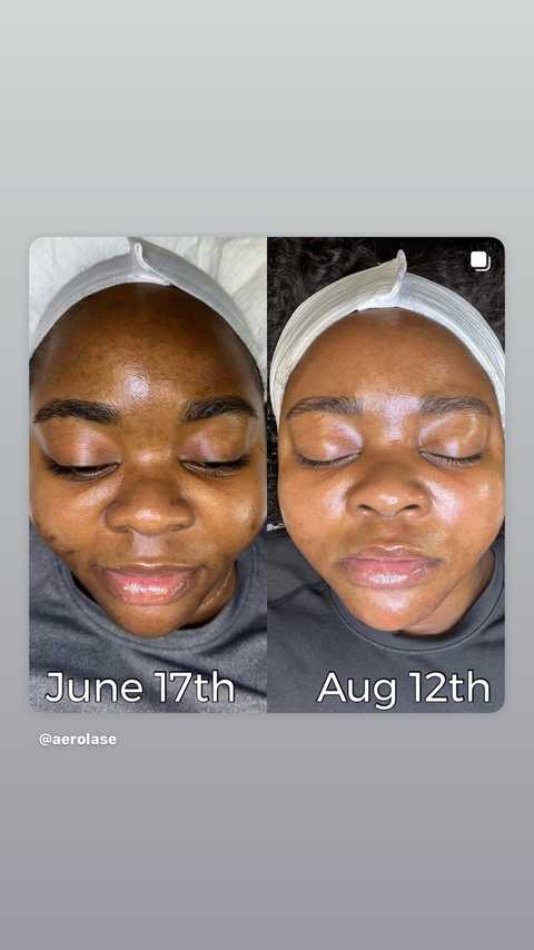 gallery image in our gallery