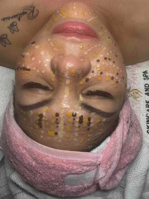 gallery image in our gallery