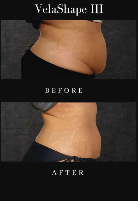 gallery image in our gallery