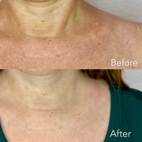 gallery image in our gallery