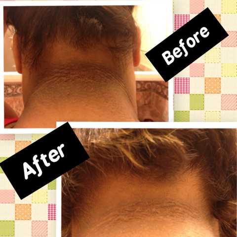 gallery image in our gallery