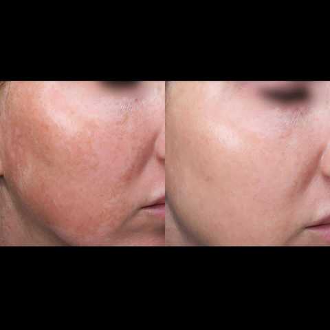 gallery image in our gallery