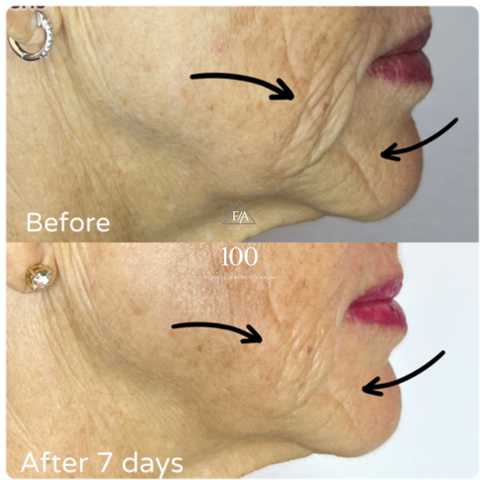 gallery image in our gallery