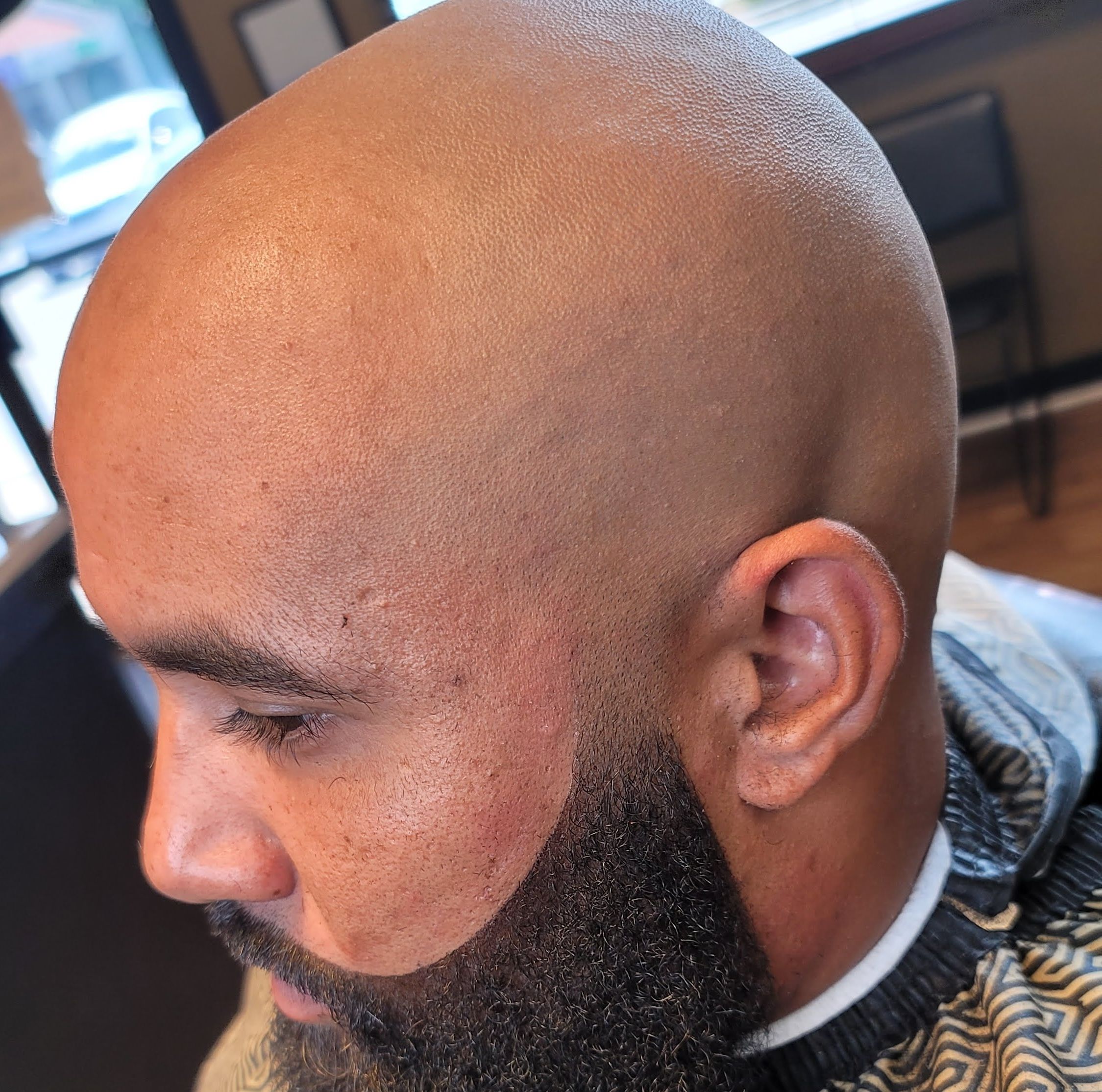 Bald Head