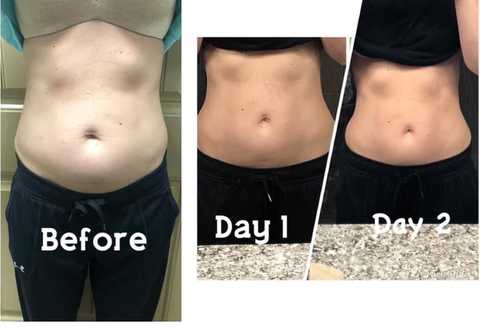 gallery image in our gallery