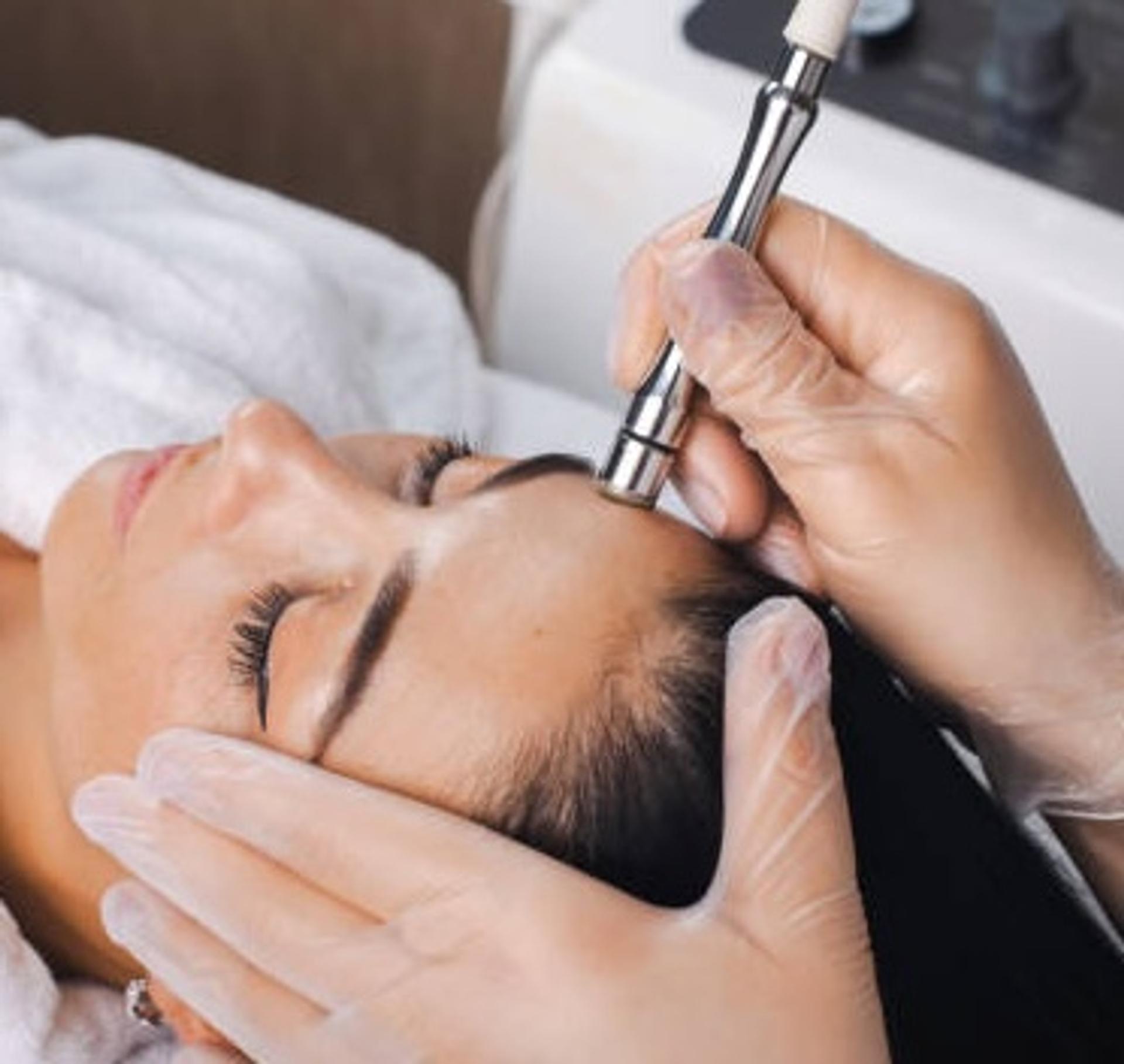 Microdermabrasion image