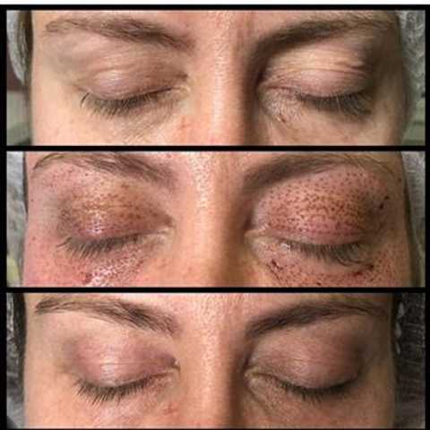 gallery image in our gallery