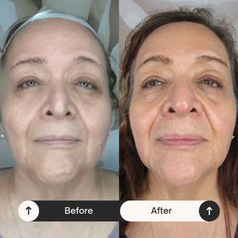 gallery image in our gallery