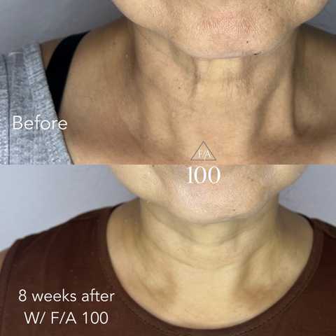 gallery image in our gallery