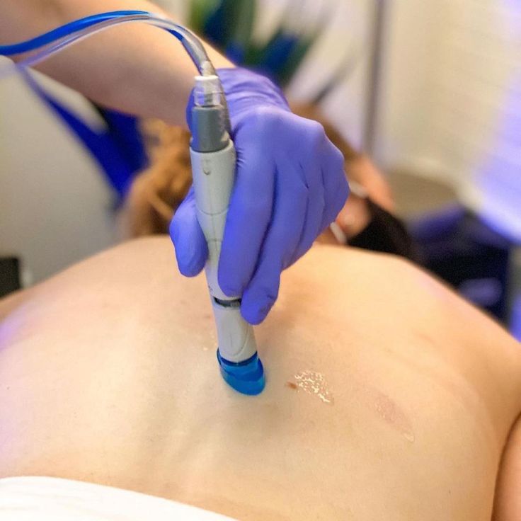 Hydrafacial Treatments
