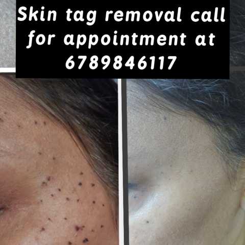 gallery image in our gallery