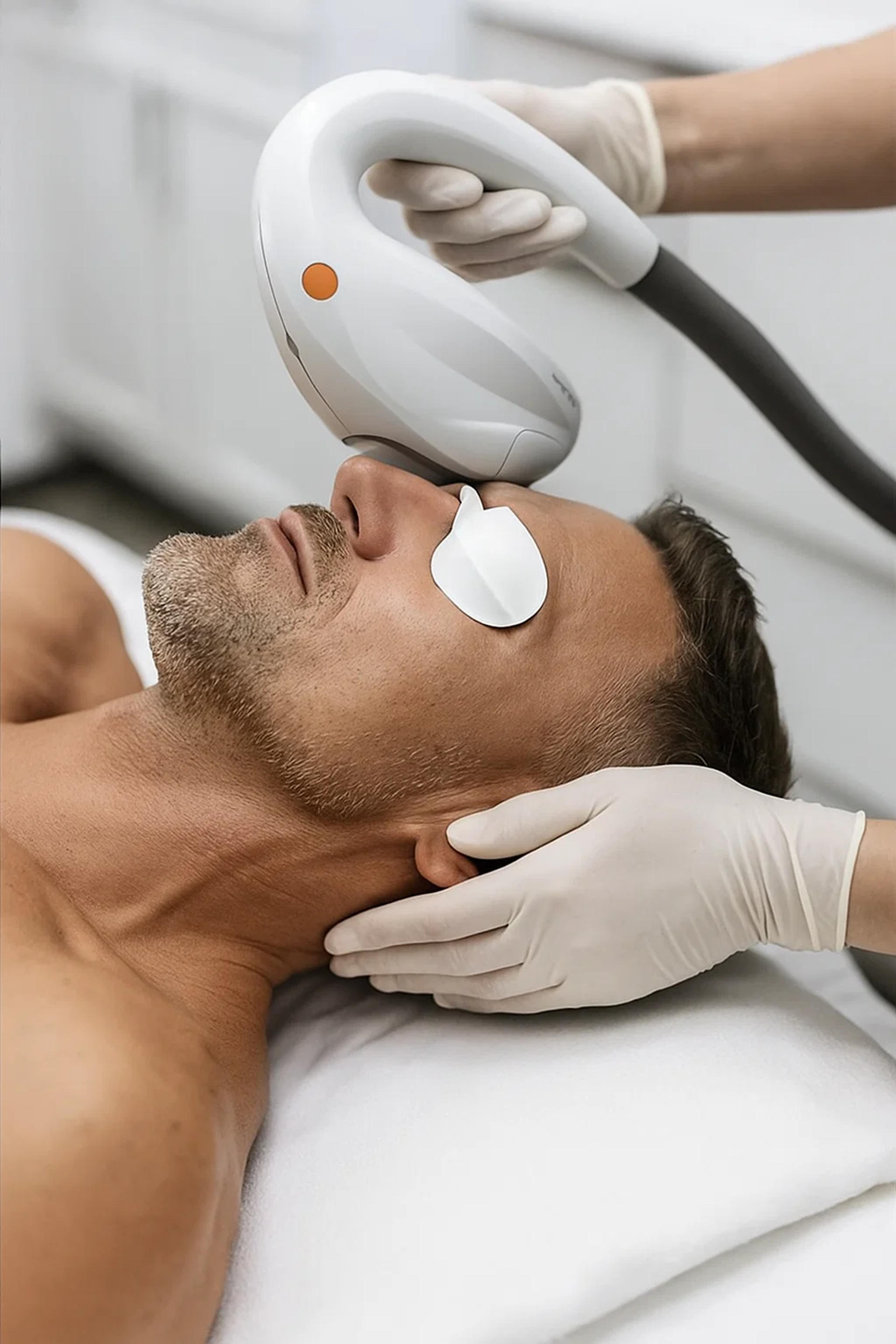IPL - Photofacial image